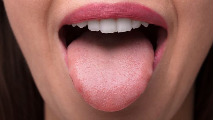 Pourquoi nettoyer sa langue fait vraiment partie de l'hygiène dentaire